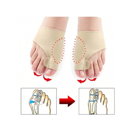 Séparateur d'orteils Correcteur d'hallux valgus, Attelle orthopédique pour oignons de pied, Correcteur d'os de pied, Ajusteur de pouce, Chaussette de pédicure, Redresseur - 38341214