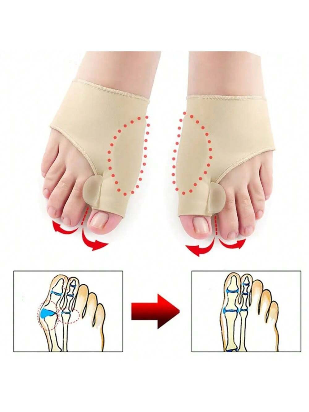 Séparateur d'orteils Correcteur d'hallux valgus, Attelle orthopédique pour oignons de pied, Correcteur d'os de pied, Ajusteur de pouce, Chaussette de pédicure, Redresseur - 38341214